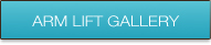 armlift-gallery-btn