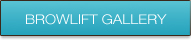 browlift-gallery-btn