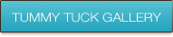 tummytuck-gallery-btn